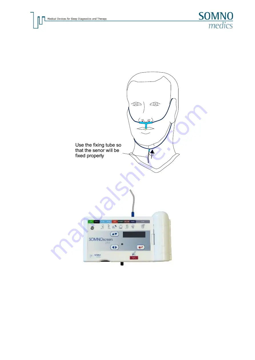 SOMNOmedics SOMNOscreen plus Instruction Manual Download Page 32