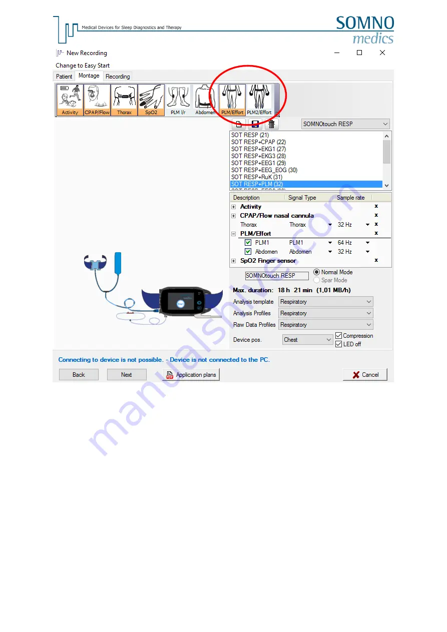 SOMNOmedics SOMNOtouch RESP PLM Instruction Manual Download Page 6