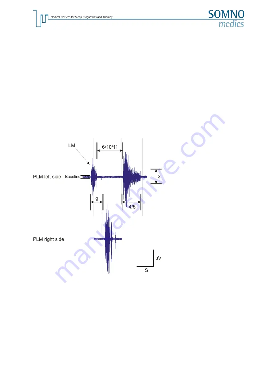 SOMNOmedics SOMNOtouch RESP PLM Instruction Manual Download Page 11