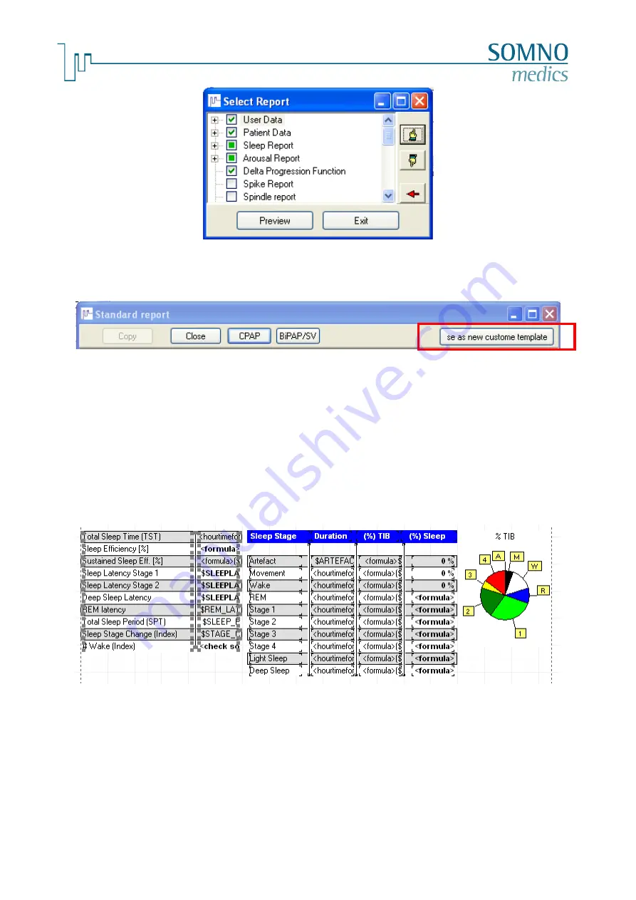 SOMNOmedics SOMNOwatch plus BP Instruction Manual Download Page 63