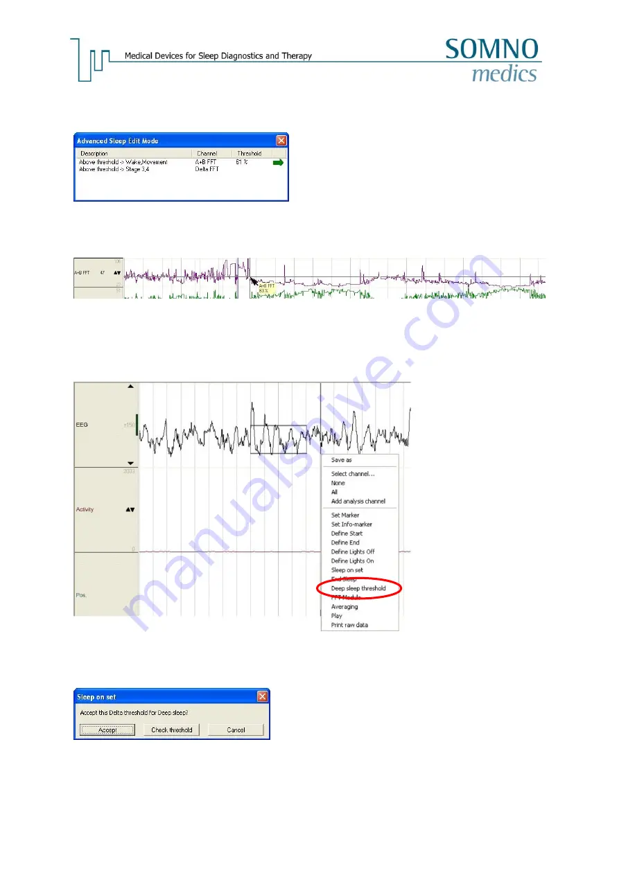 SOMNOmedics SOMNOwatch plus Instruction Manual Download Page 59