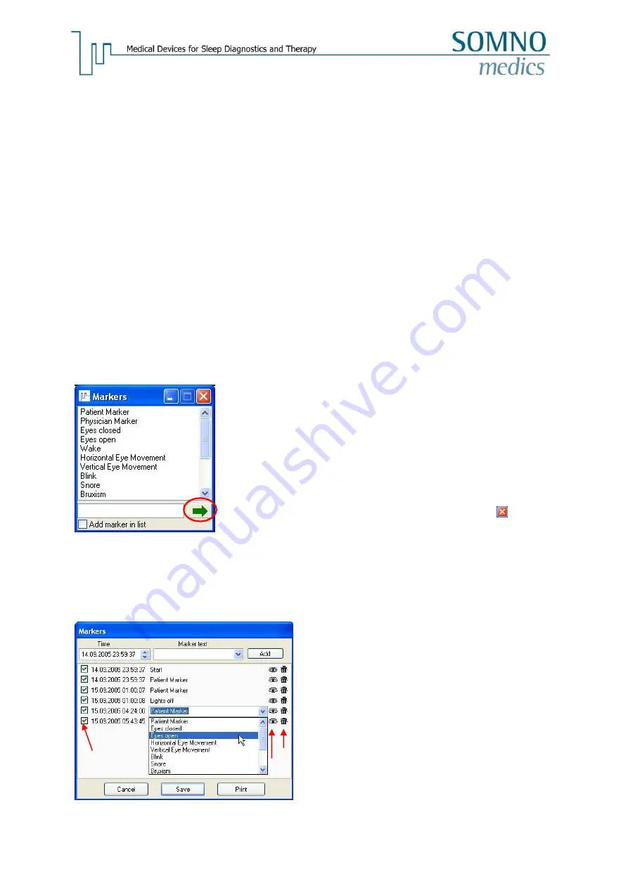 SOMNOmedics SOMNOwatch plus Instruction Manual Download Page 131