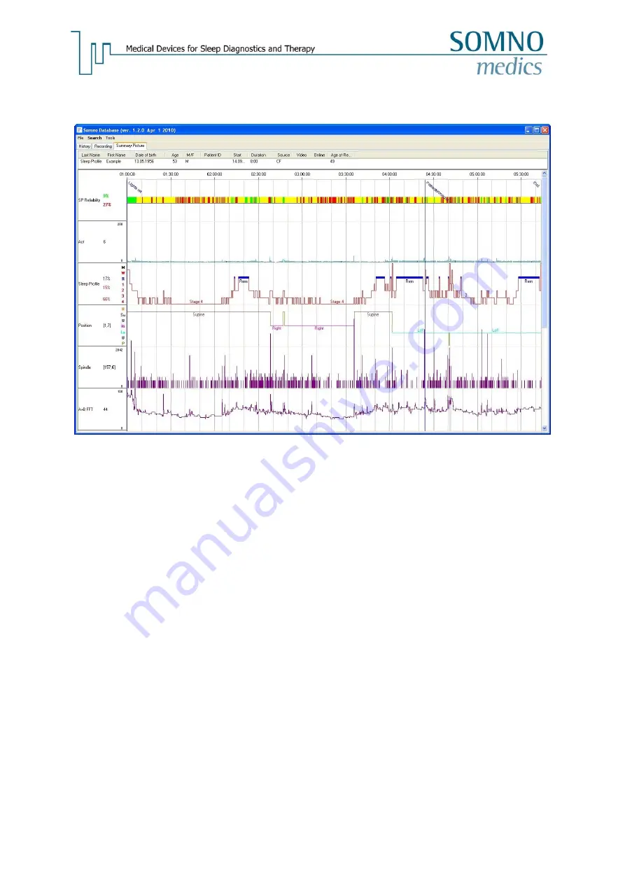 SOMNOmedics SOMNOwatch plus Instruction Manual Download Page 152