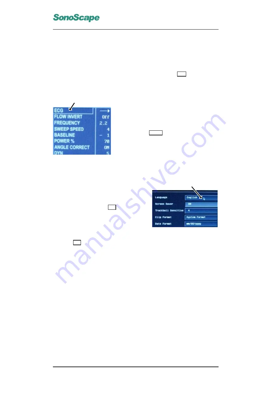 Sonoscape SSI-5500 User Manual Download Page 36