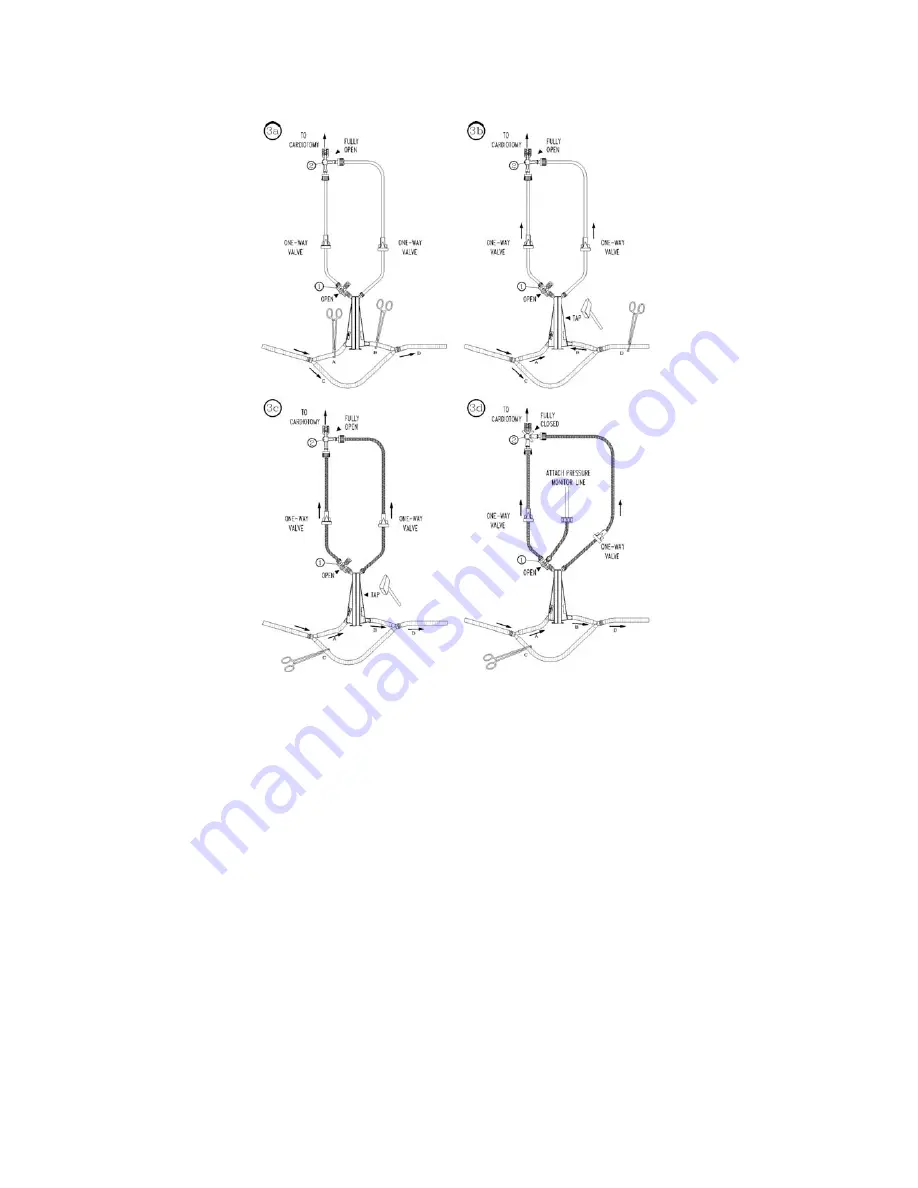 sorin dideco KIDS D130 Instructions For Use Manual Download Page 58