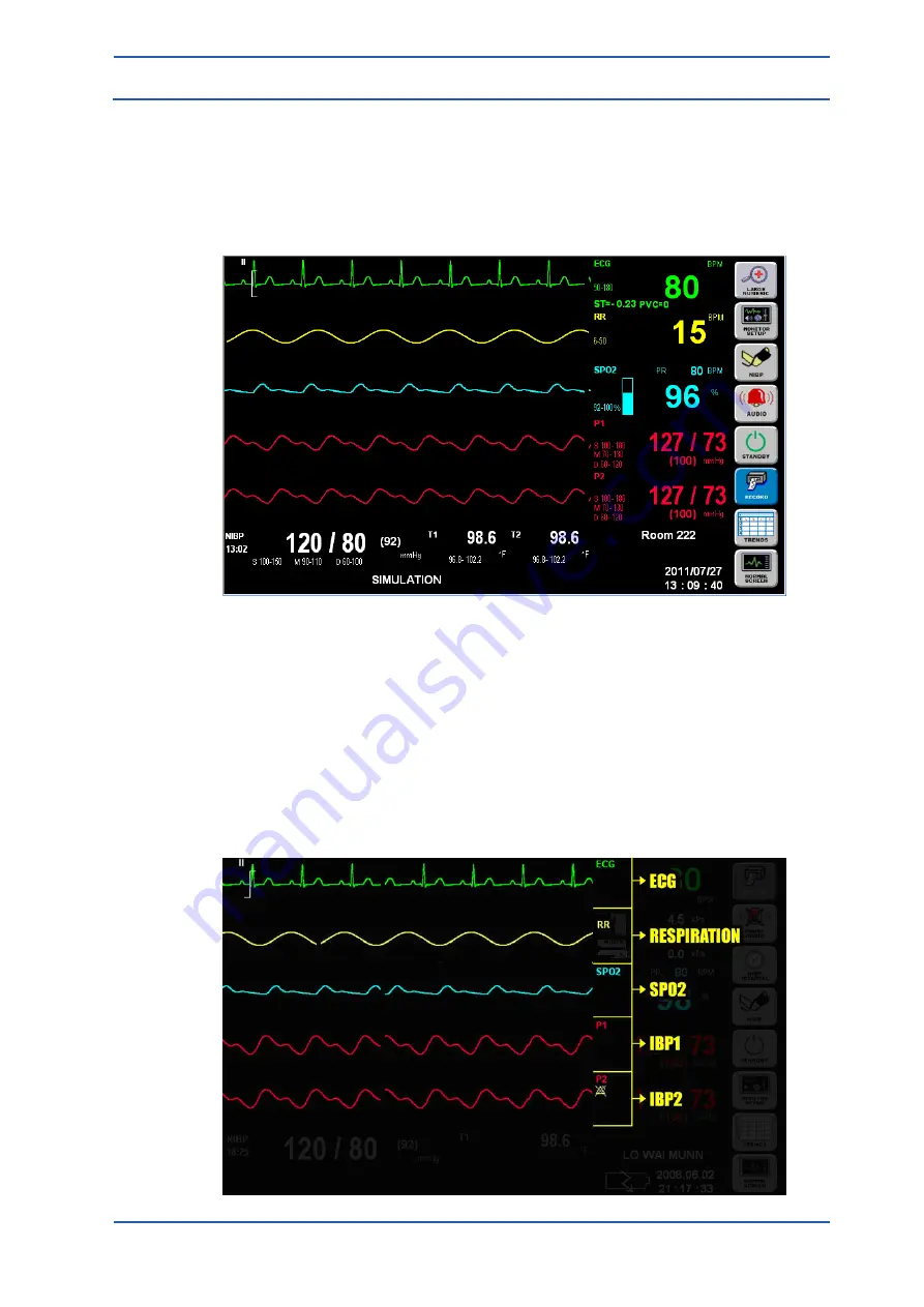 Spacelabs Healthcare 93300 Operation Manual Download Page 18