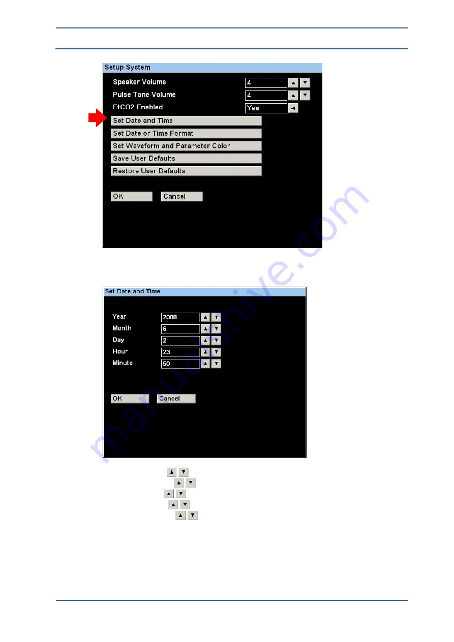 Spacelabs Healthcare 93300 Operation Manual Download Page 30