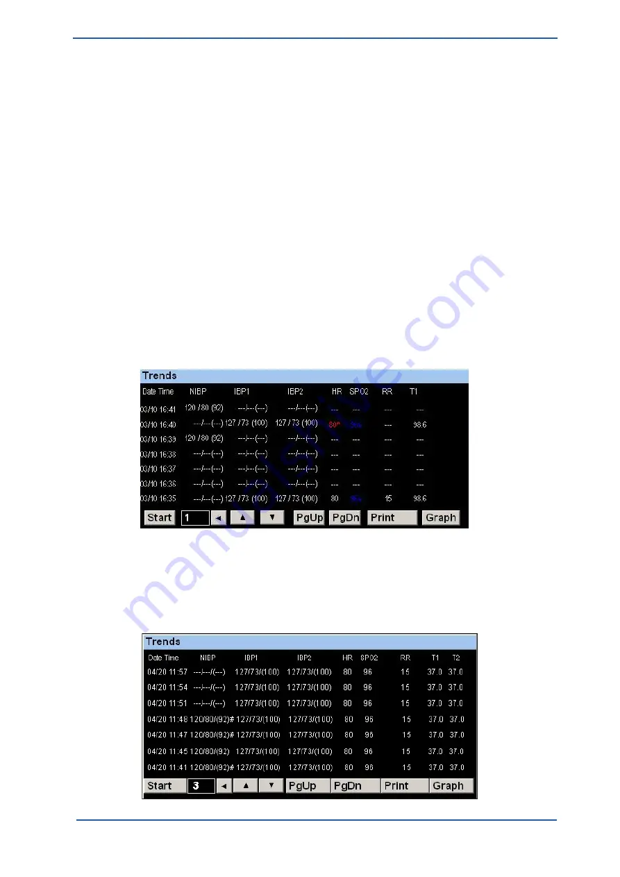 Spacelabs Healthcare 93300 Operation Manual Download Page 48