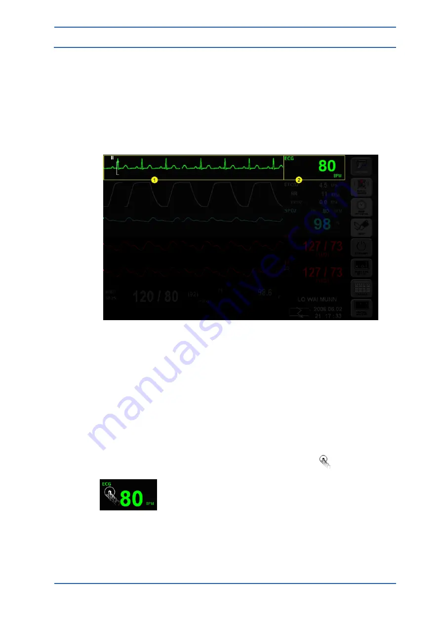 Spacelabs Healthcare 93300 Operation Manual Download Page 80