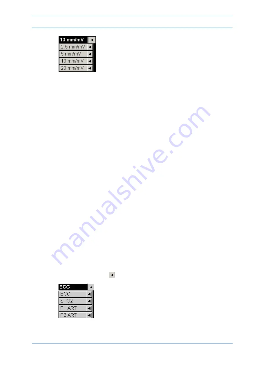 Spacelabs Healthcare 93300 Operation Manual Download Page 83