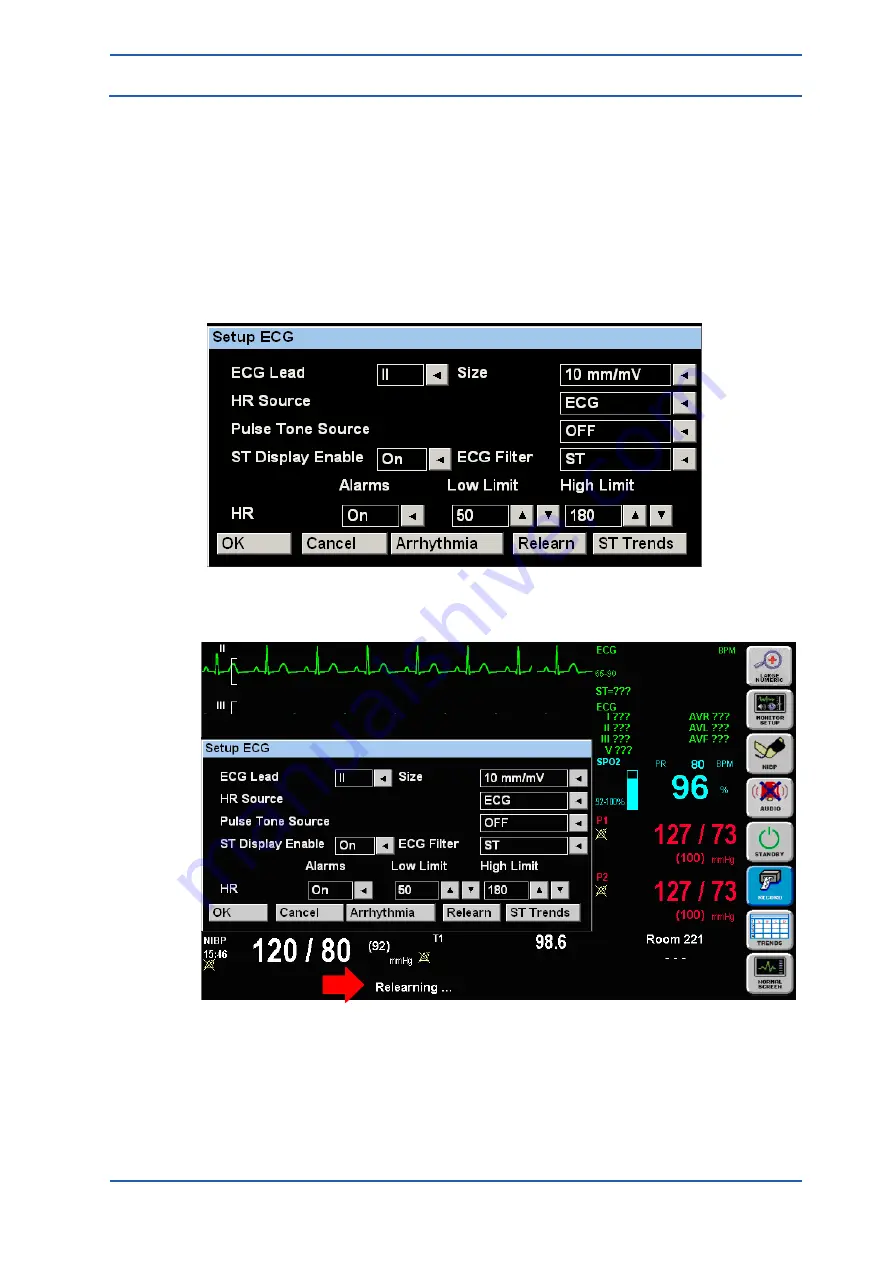 Spacelabs Healthcare 93300 Скачать руководство пользователя страница 86