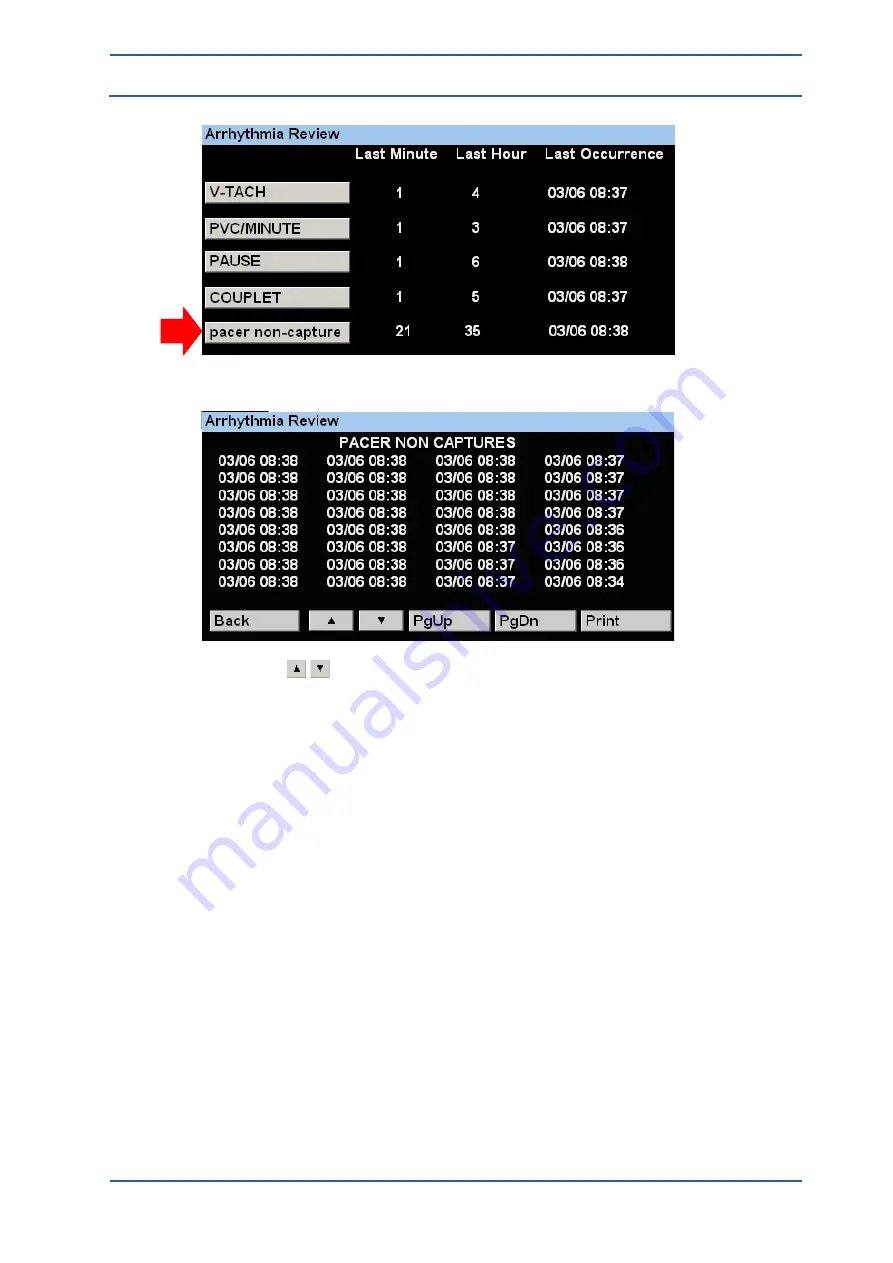 Spacelabs Healthcare 93300 Operation Manual Download Page 95