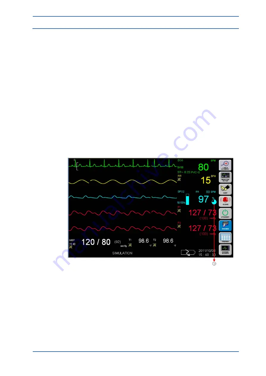 Spacelabs Healthcare 93300 Operation Manual Download Page 118