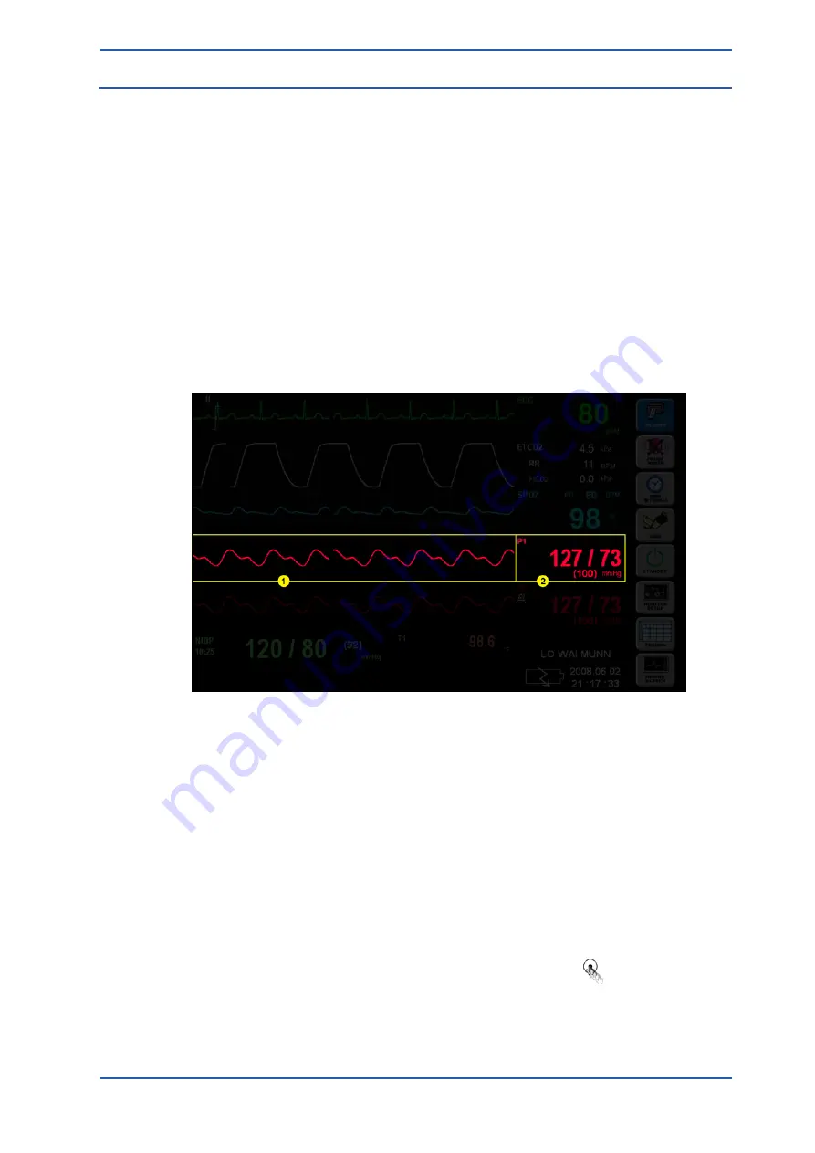 Spacelabs Healthcare 93300 Operation Manual Download Page 125