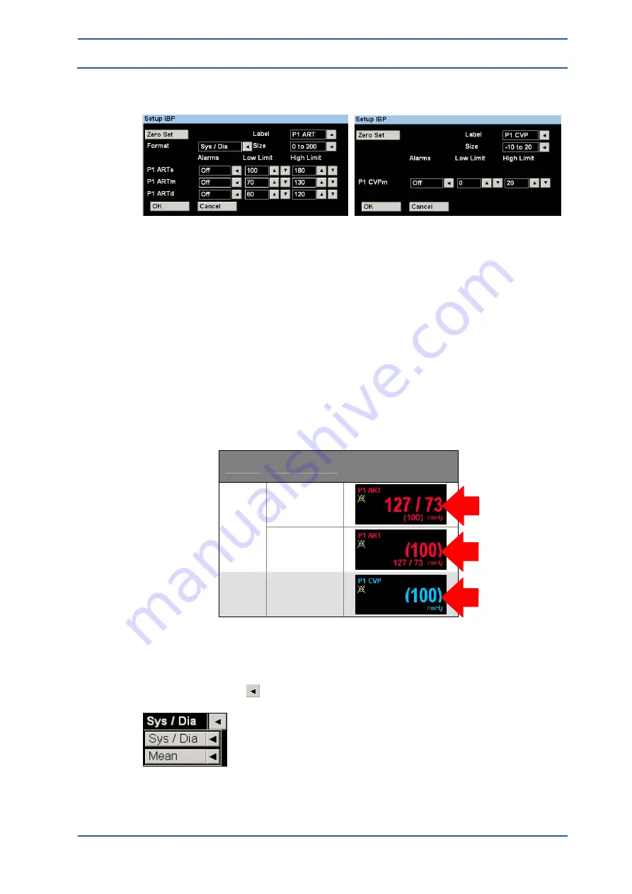 Spacelabs Healthcare 93300 Operation Manual Download Page 128