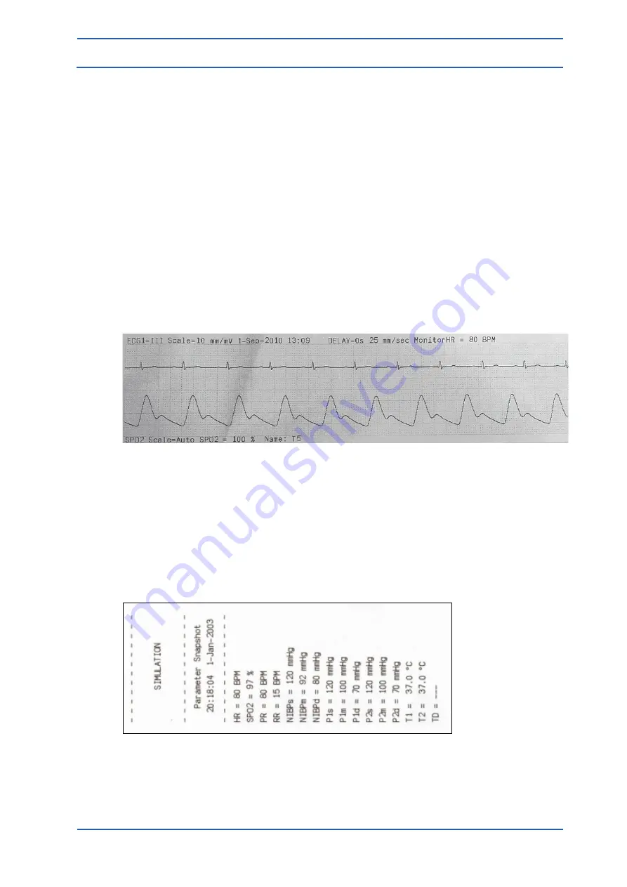 Spacelabs Healthcare 93300 Operation Manual Download Page 146