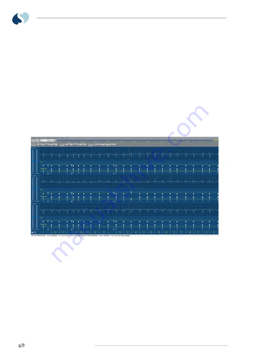 Spacelabs Healthcare 98000 Operation Manual Download Page 32