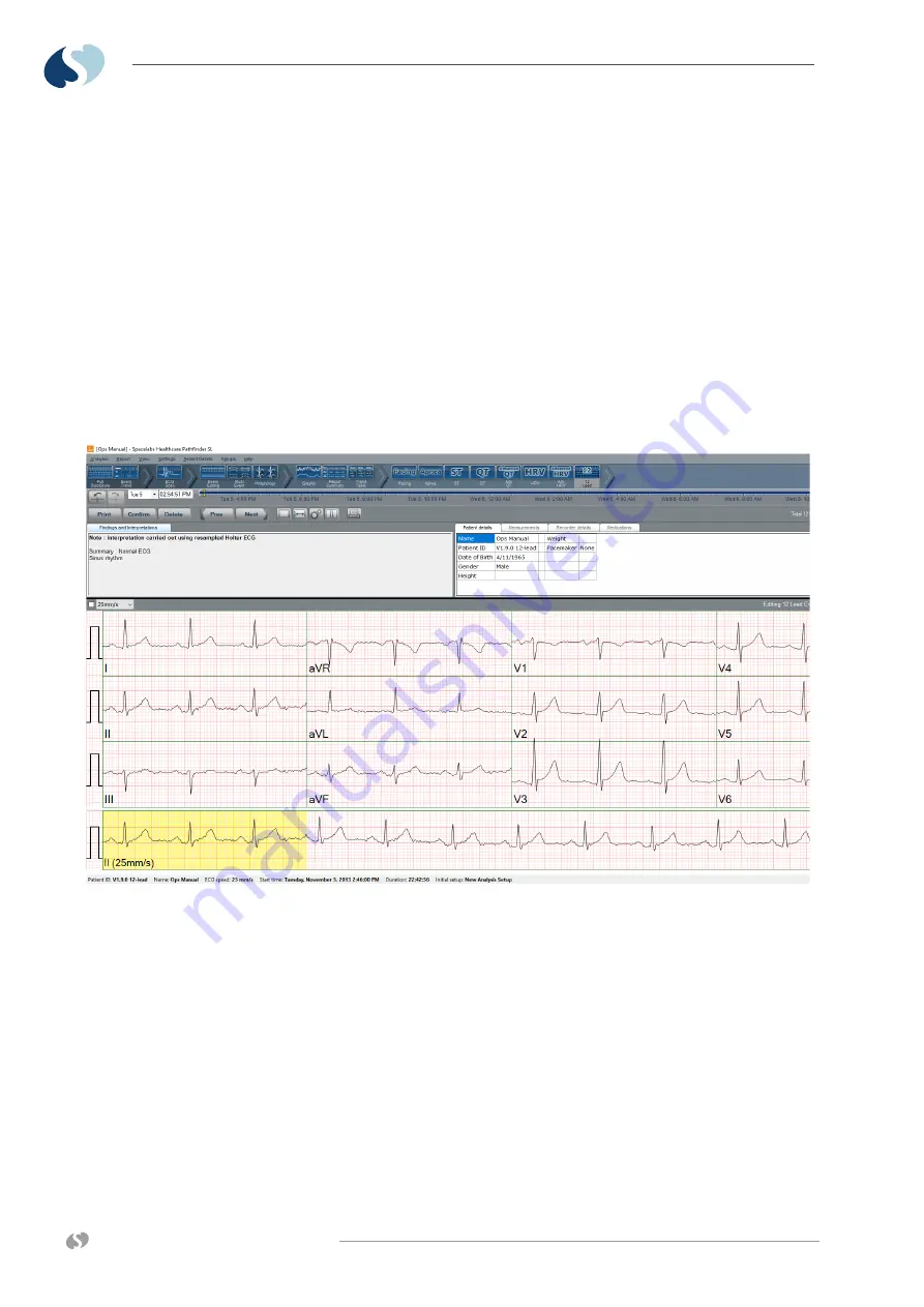 Spacelabs Healthcare 98000 Operation Manual Download Page 52