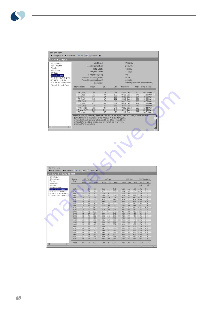 Spacelabs Healthcare 98000 Operation Manual Download Page 104