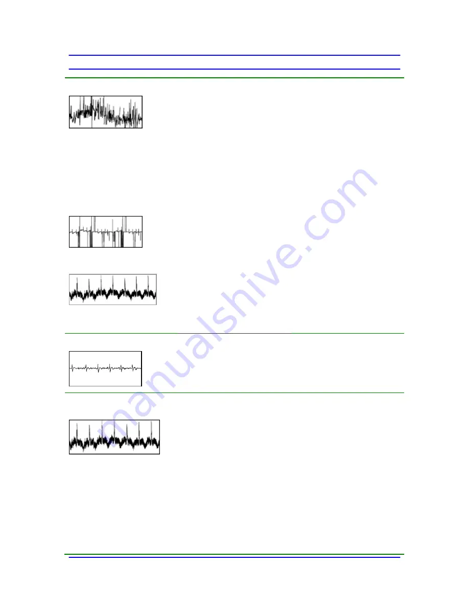 Spacelabs Healthcare elance 5 Service Manual Download Page 66