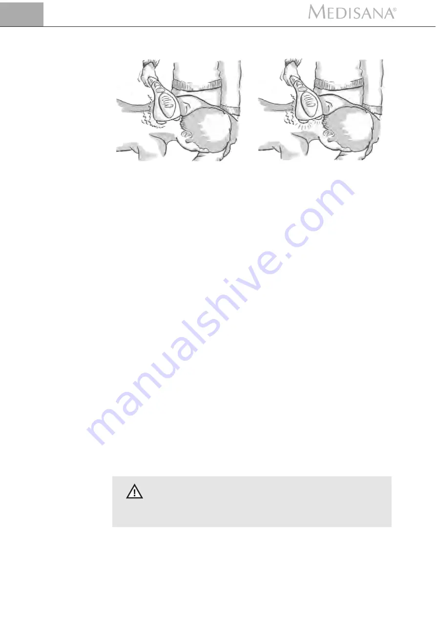 Sport-Tec Medisana 27064 Manual Download Page 11