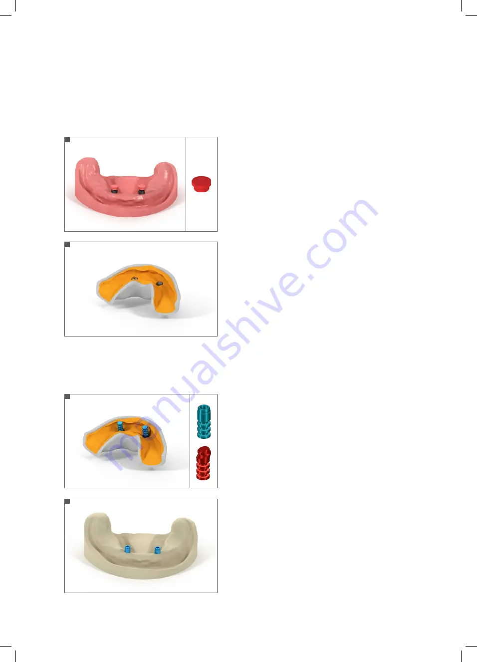 Straumann Novaloc Technical Information Download Page 5