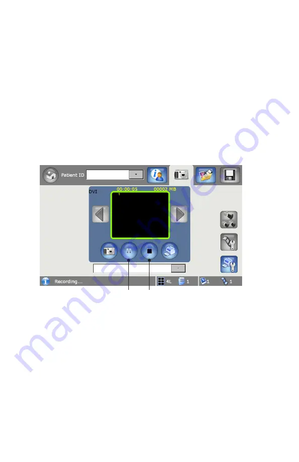 Stryker 0240050988 Manual Download Page 30