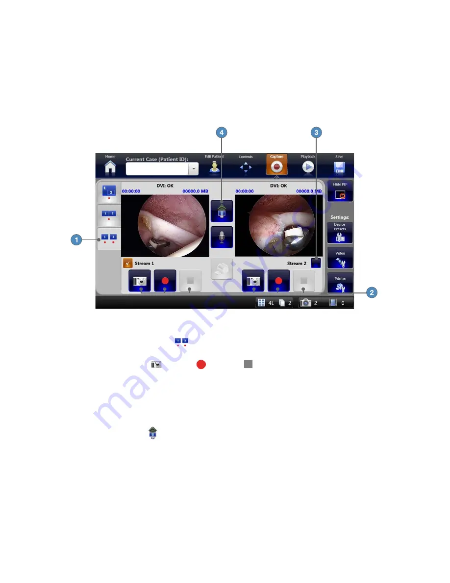 Stryker SDC3 Manual Download Page 29