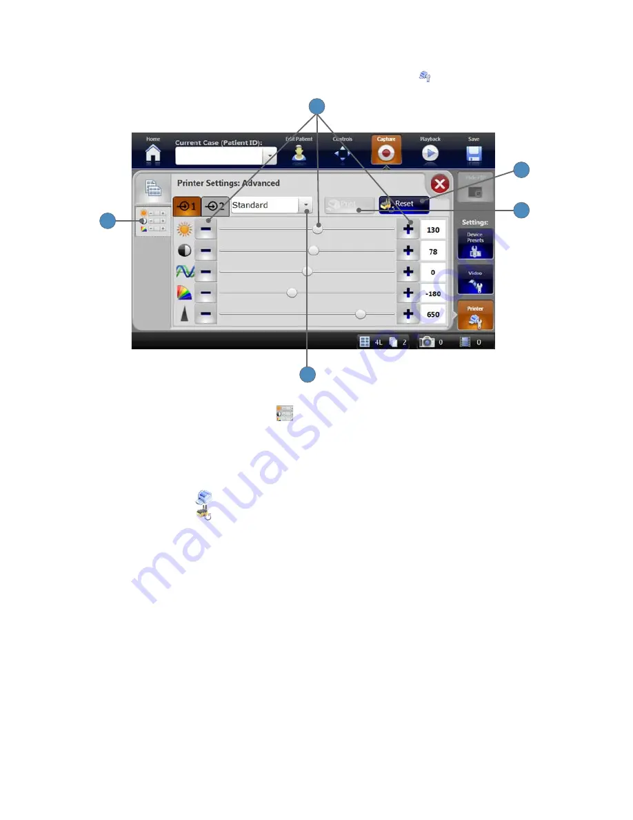 Stryker SDC3 Manual Download Page 39