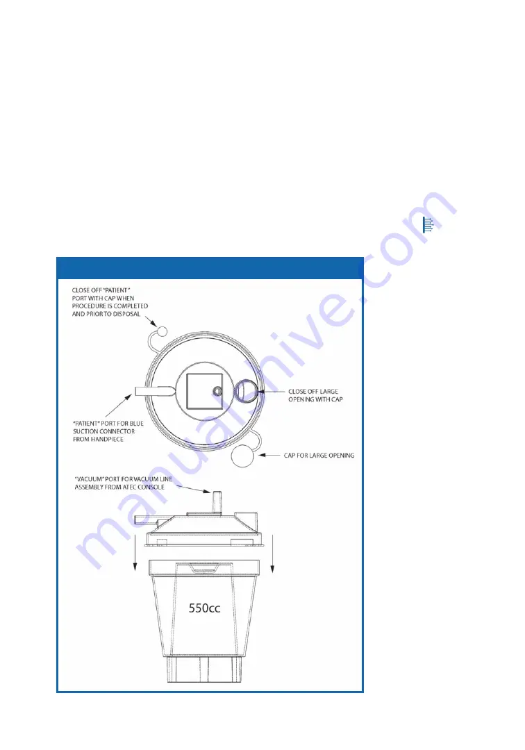 Suros ATEC Sapphire Unit Operator'S Manual Download Page 15