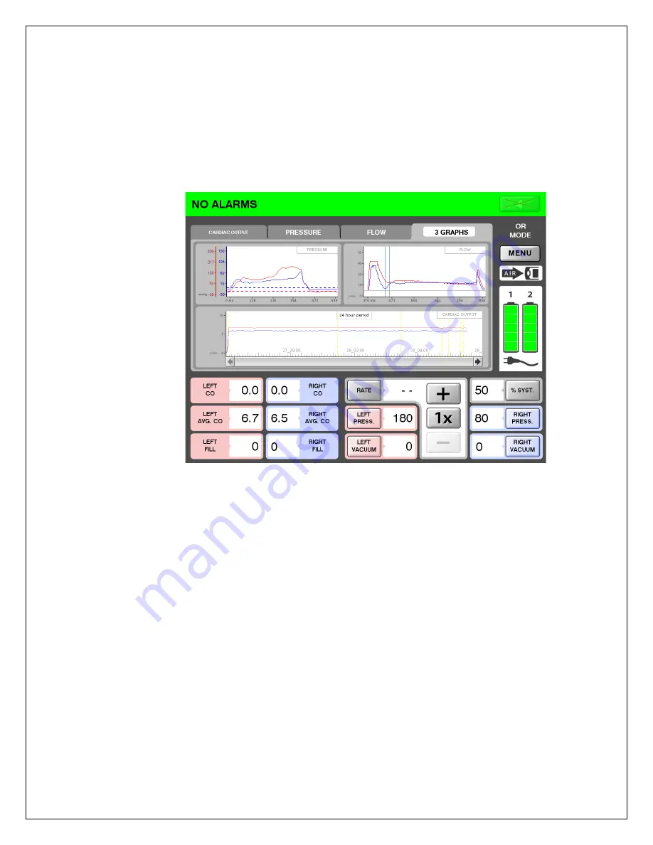 SynCardia Companion 2 Driver System Operator'S Manual Download Page 47