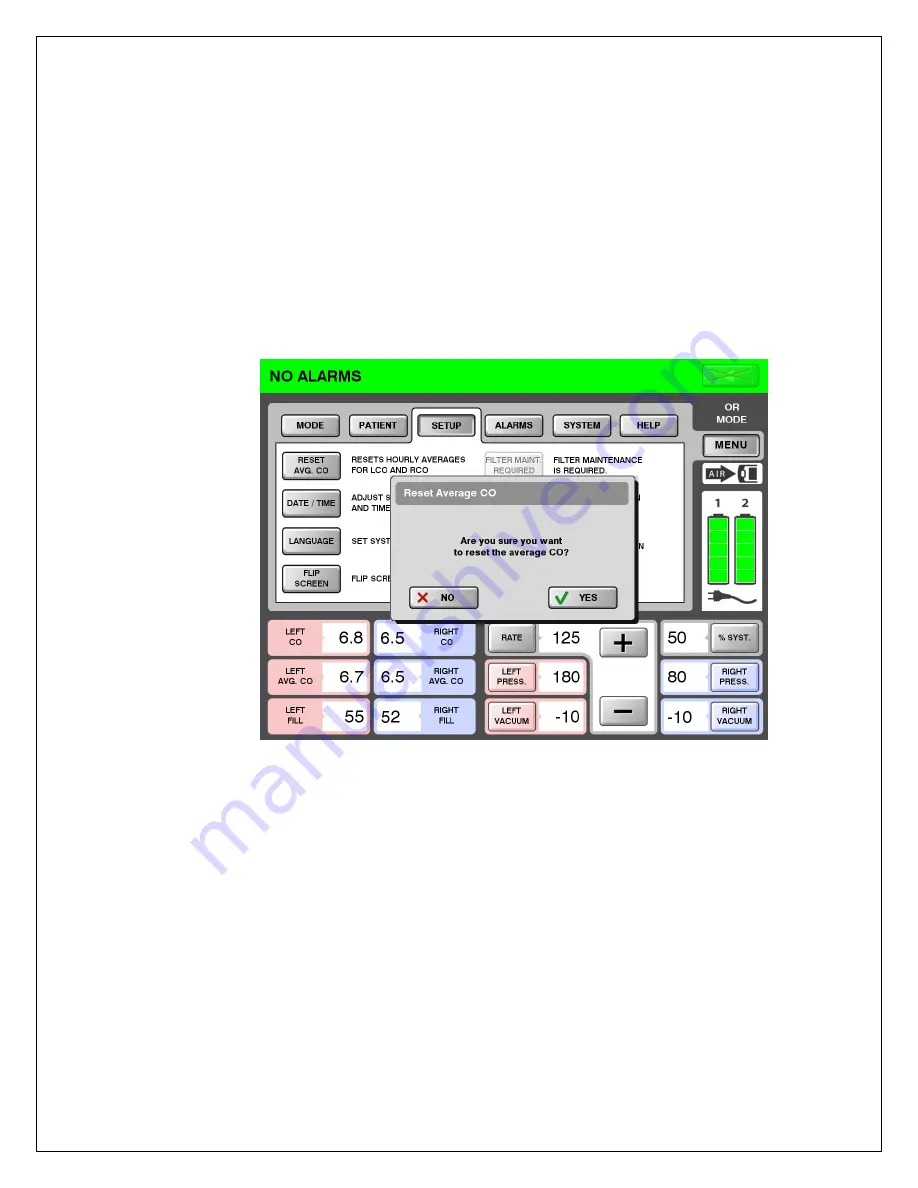 SynCardia Companion 2 Driver System Скачать руководство пользователя страница 53