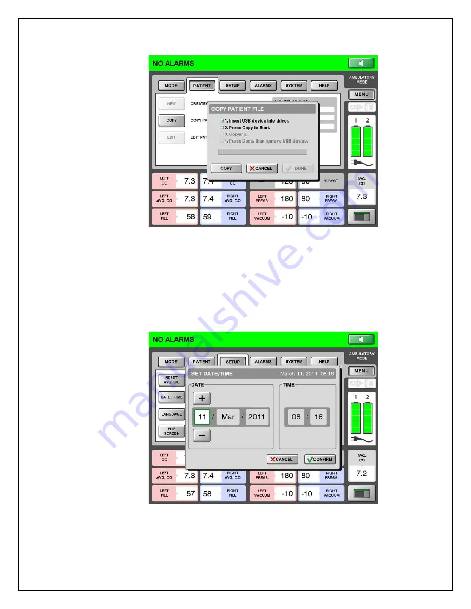 SynCardia Companion 2 Driver System Скачать руководство пользователя страница 64