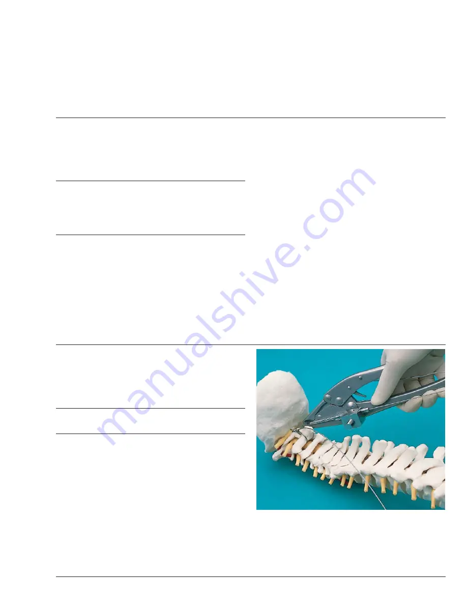 Synthes Spine Cable System Technical Manual Download Page 11