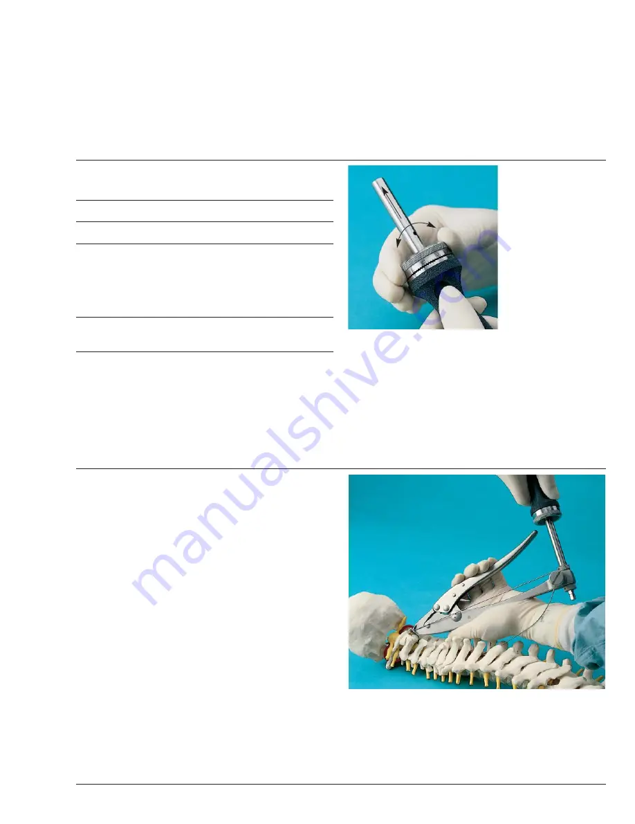 Synthes Spine Cable System Technical Manual Download Page 15