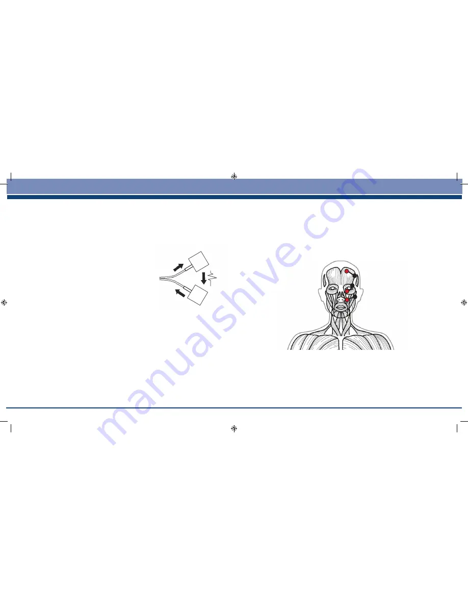 TensCare Flexistim Instructions For Use Manual Download Page 22