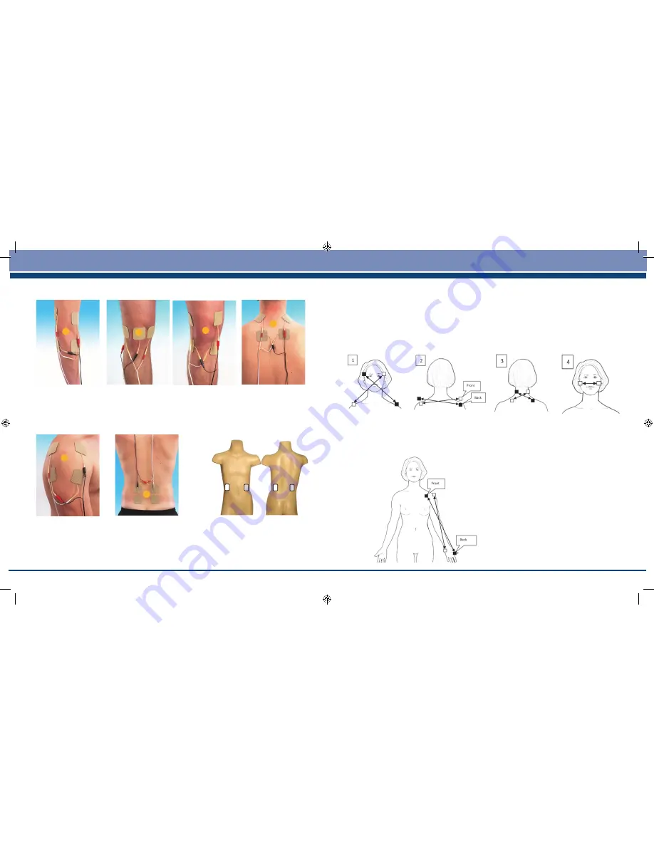 TensCare Flexistim Instructions For Use Manual Download Page 25