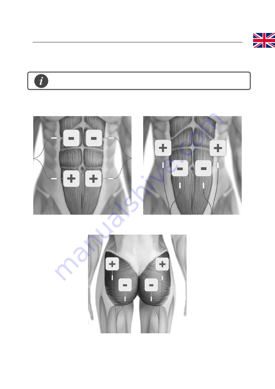 TensCare Perfect EMS Instructions For Use Manual Download Page 19