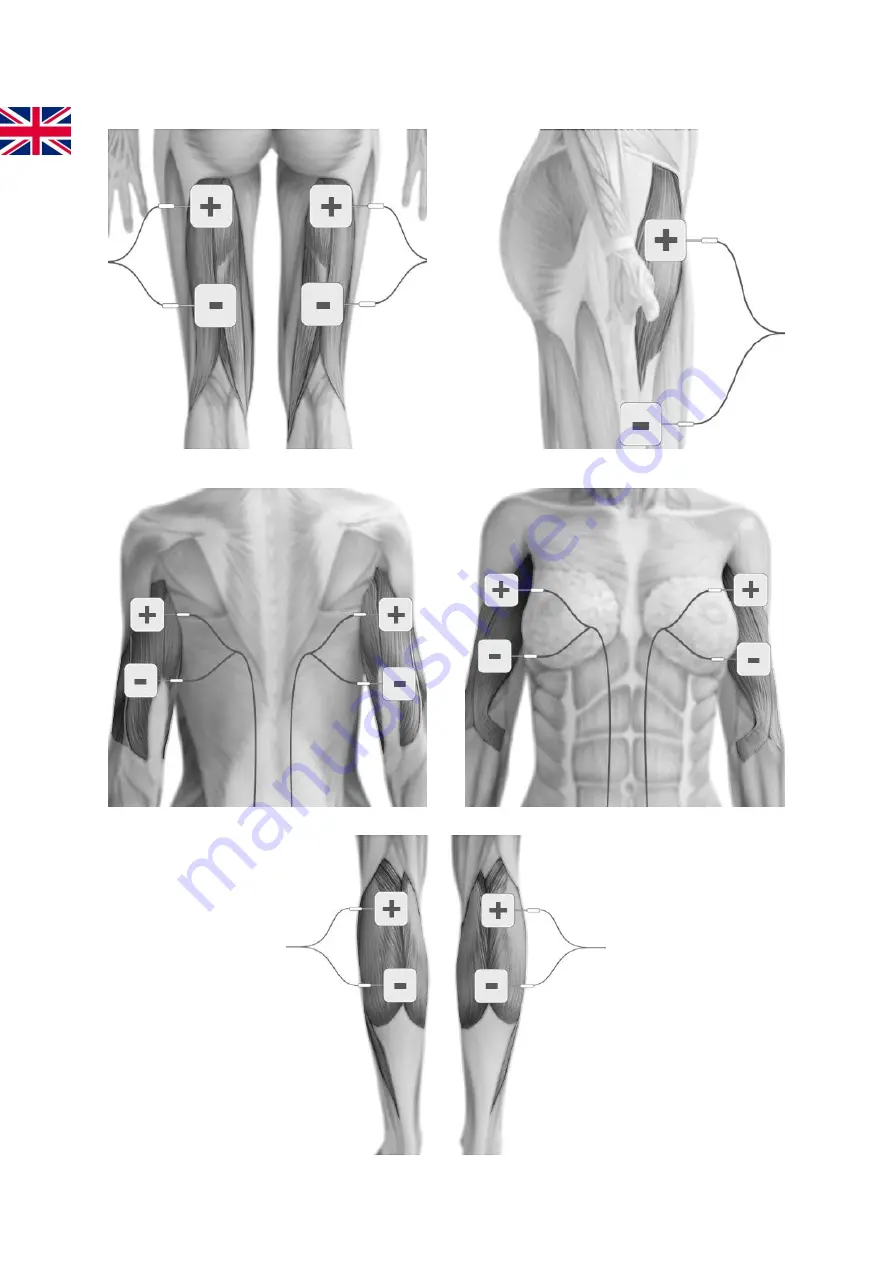 TensCare Perfect EMS Instructions For Use Manual Download Page 20