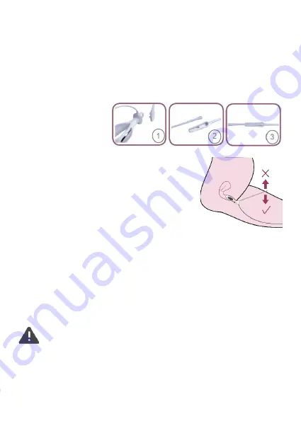 TensCare Probe Liberty loop X-VPL Скачать руководство пользователя страница 20