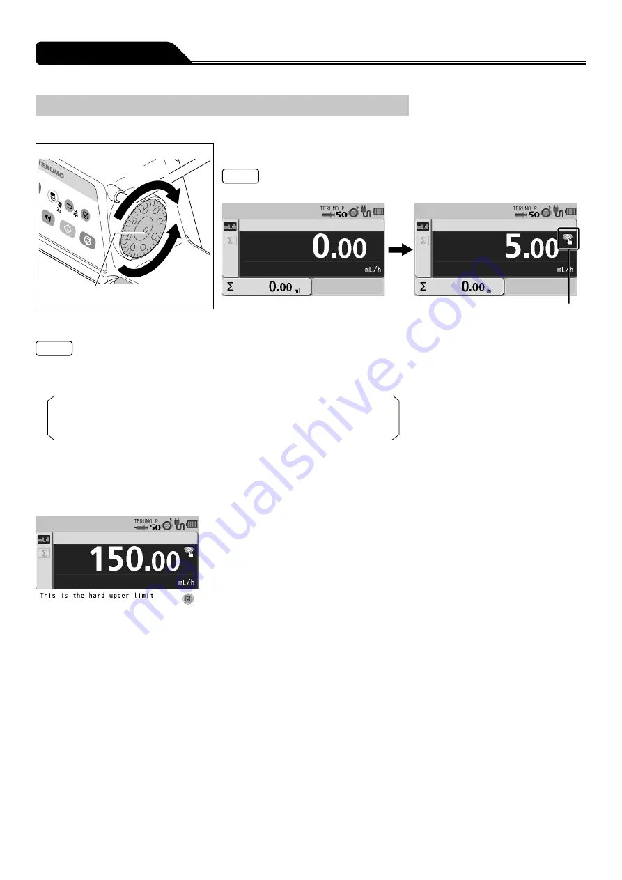 Terumo TERUFUSION TE-SS730 Скачать руководство пользователя страница 30