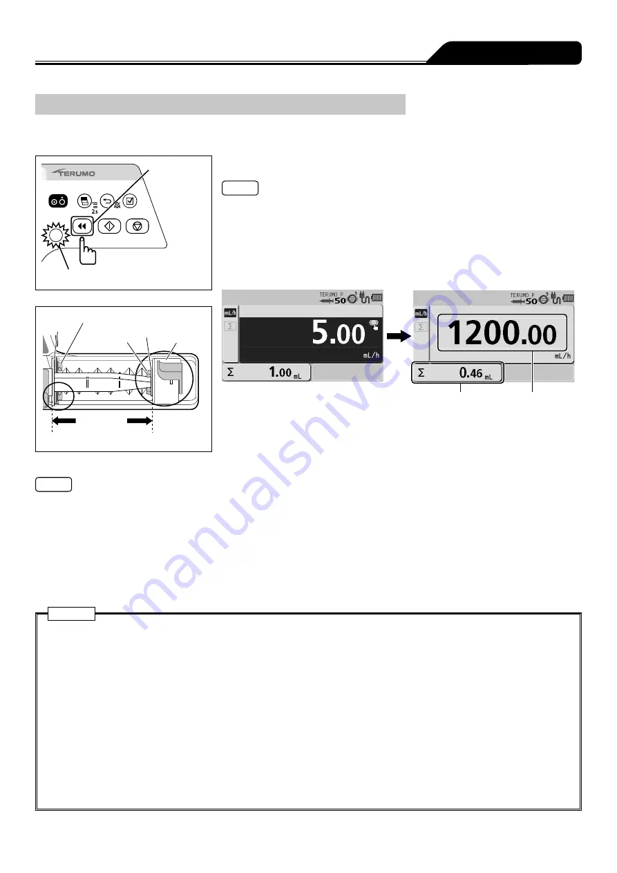 Terumo TERUFUSION TE-SS730 Instruction Manual Download Page 33