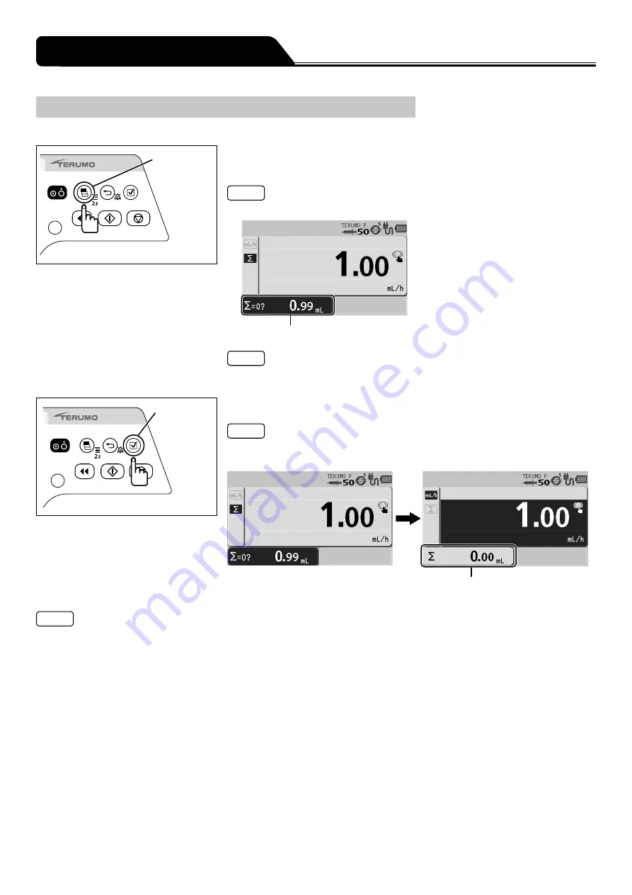 Terumo TERUFUSION TE-SS730 Instruction Manual Download Page 38