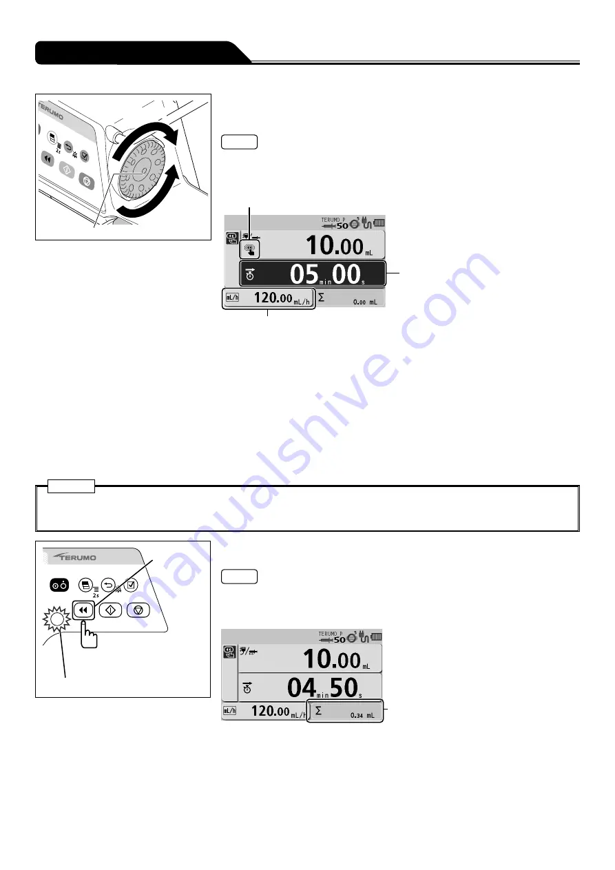 Terumo TERUFUSION TE-SS730 Скачать руководство пользователя страница 64