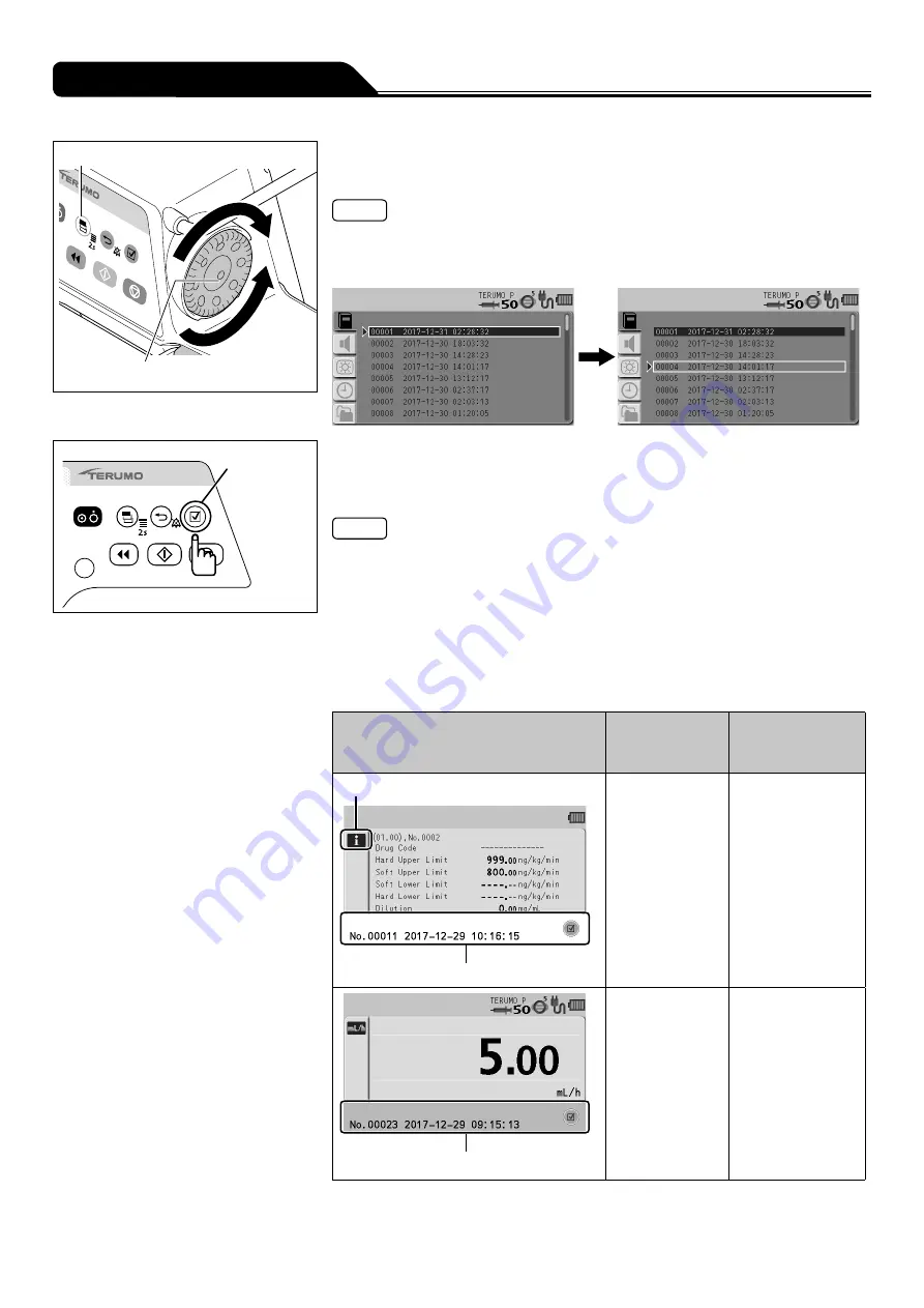 Terumo TERUFUSION TE-SS730 Instruction Manual Download Page 72