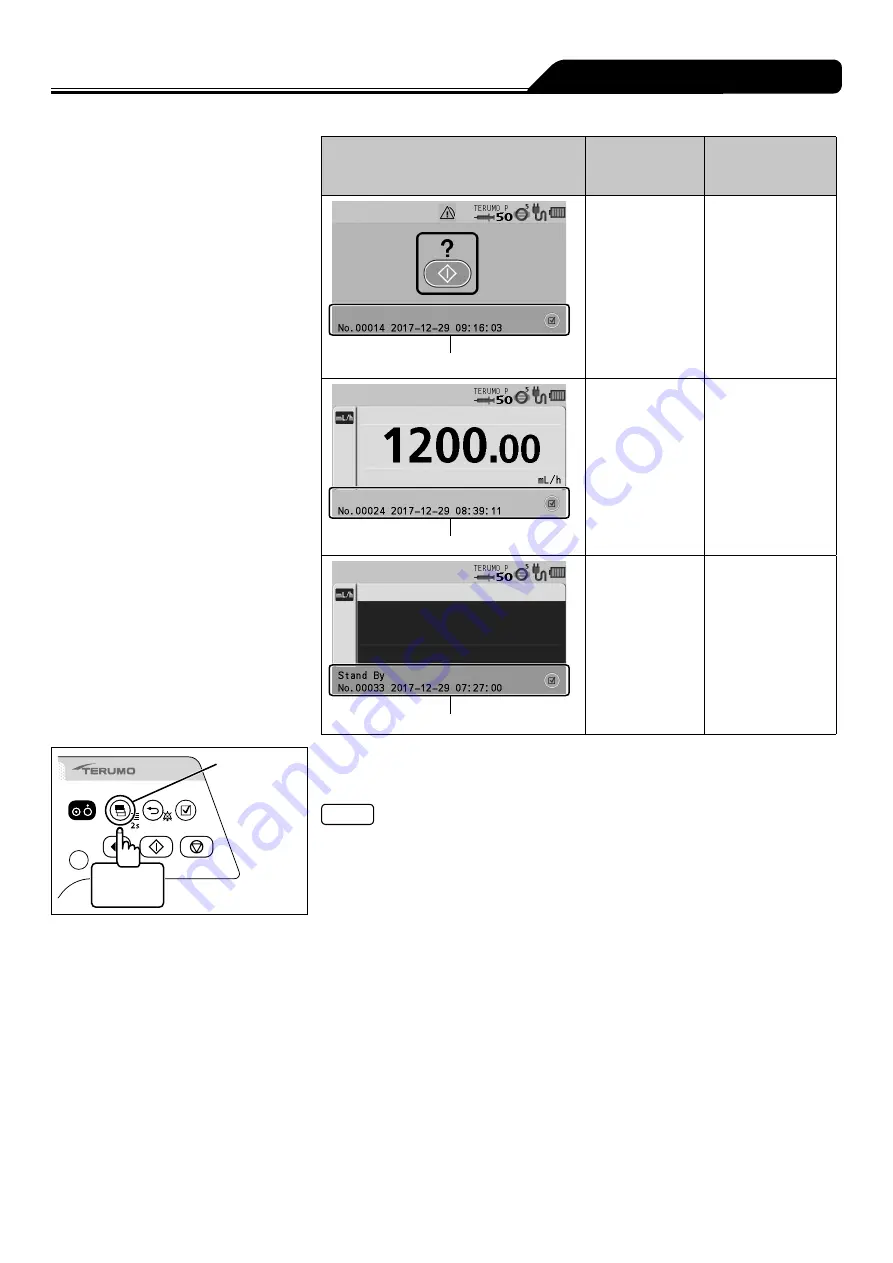 Terumo TERUFUSION TE-SS730 Скачать руководство пользователя страница 73