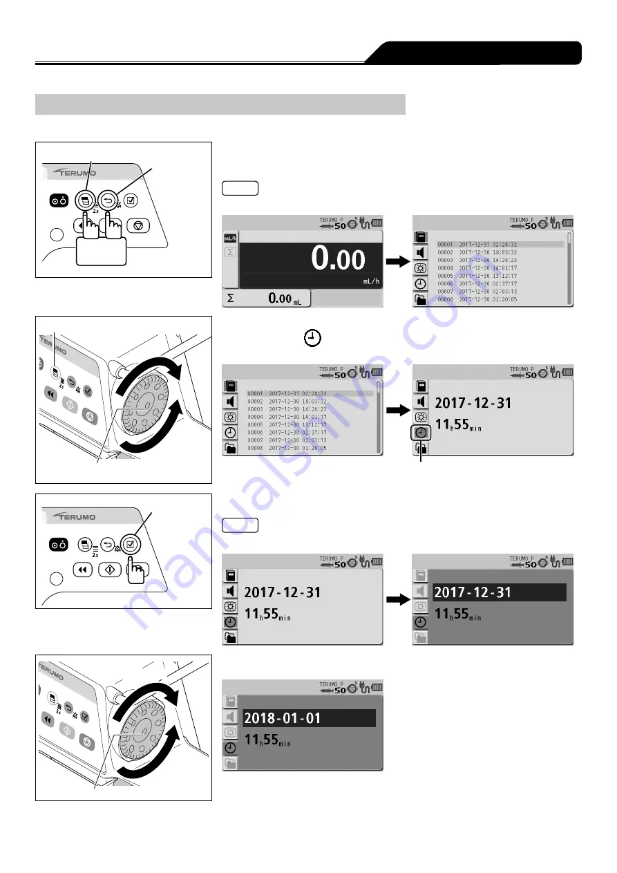 Terumo TERUFUSION TE-SS730 Instruction Manual Download Page 79