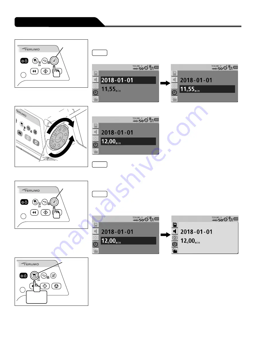 Terumo TERUFUSION TE-SS730 Instruction Manual Download Page 80