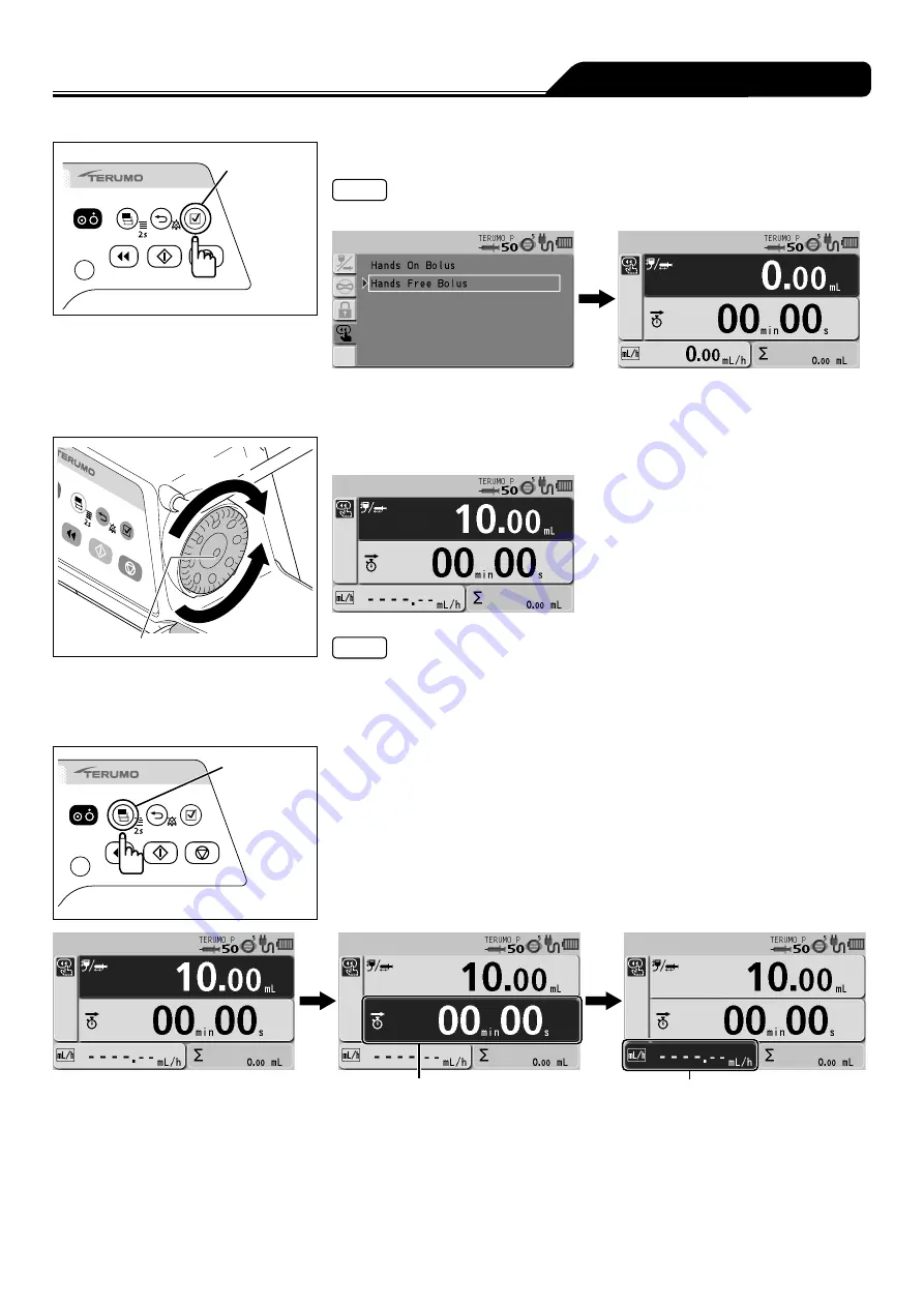 Terumo TERUFUSION TE-SS730 Instruction Manual Download Page 195