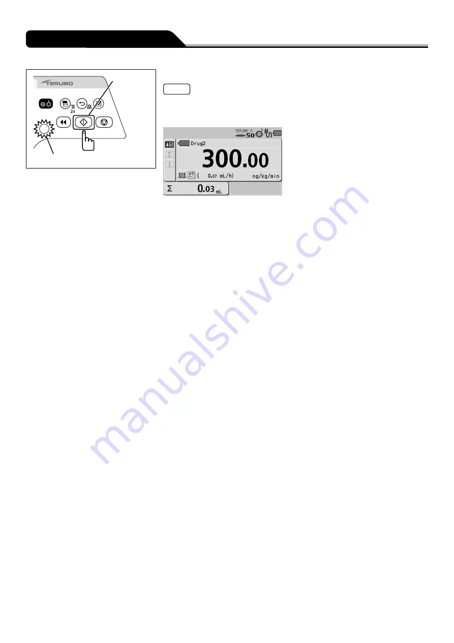 Terumo TERUFUSION TE-SS730 Instruction Manual Download Page 202